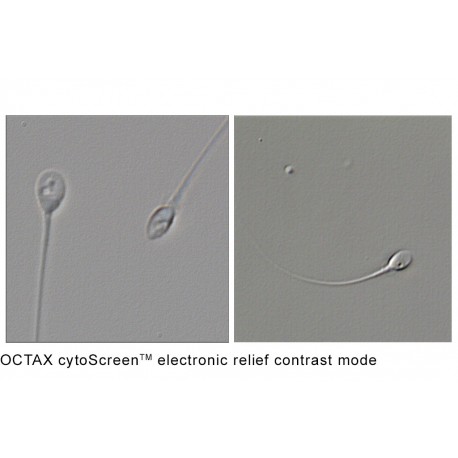 OCTAX cytoScreen